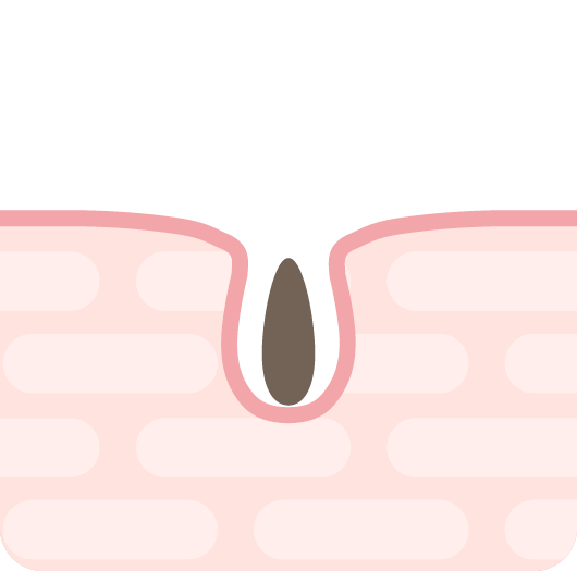 アニメーション