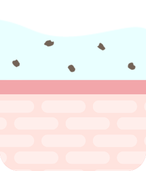 アニメーション