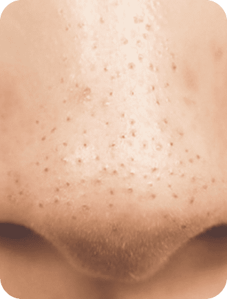 汚れのないキレイな鼻