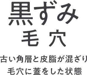 古い角層と皮脂が混ざり毛穴に蓋をした状態