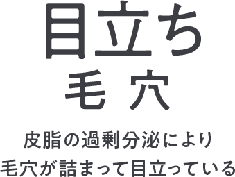 皮脂の過剰分泌により毛穴が詰まって目立っている